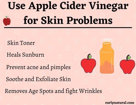 Apple Cider Vinegar for Skin Care