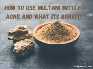 Multani Mitti for acne